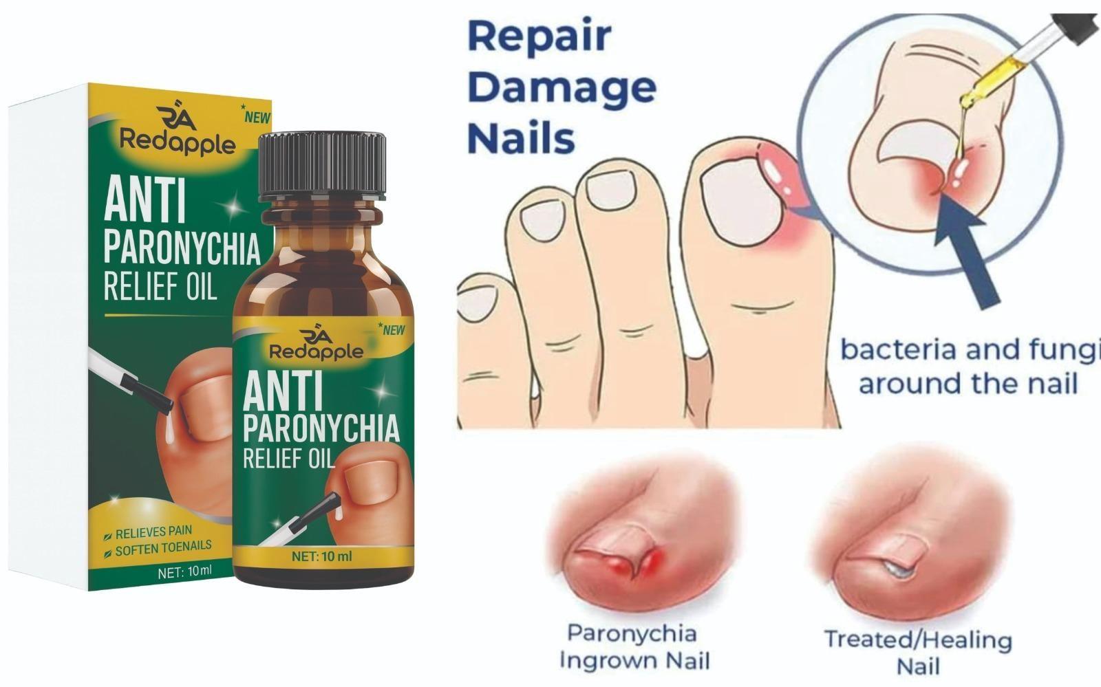 Redapple Anti Paronychia Relief Oil packaging with illustrations of nail care and oil bottle.