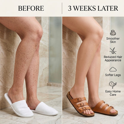 Before and after comparison of legs with text indicating improvements after 3 weeks.