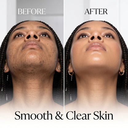 Before and after comparison of smooth and clear skin on a person with braided hair.
