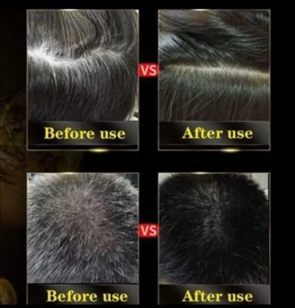 Before and after comparison of hair treatment showing visible improvement.