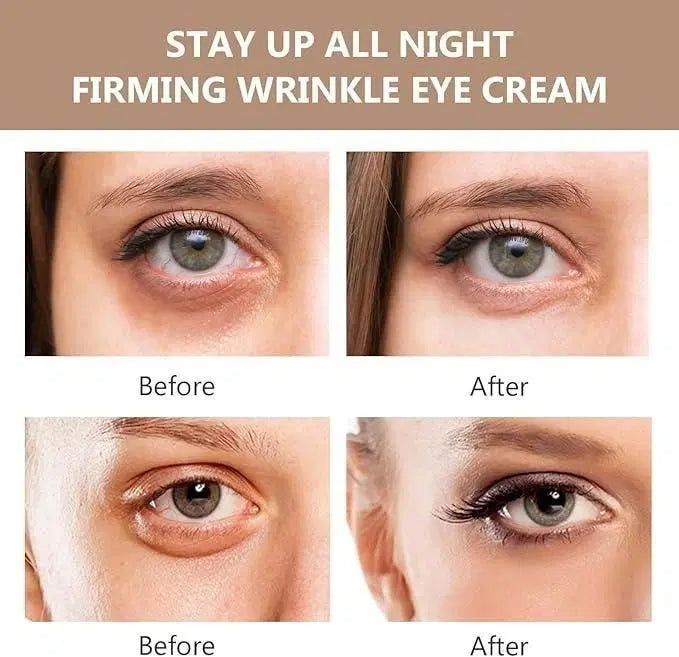 Before and after effects of a firming wrinkle eye cream on a person's eyes.