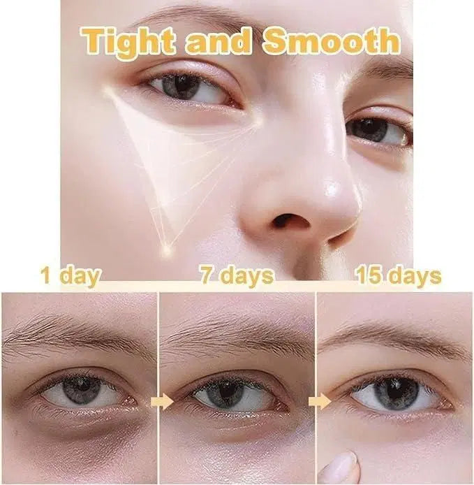 Before and after effects of a skincare product on eye area over 15 days.